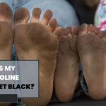 Why Is My Trampoline Turn My Feet Black?
